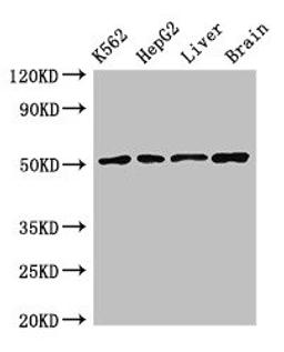 Western Blot. Positive WB detected in: K562 whole cell lysate, HepG2 whole cell lysate, Rat liver tissue, Mouse brain tissue. All lanes: RUVBL2 antibody at 2.4ug/ml. Secondary. Goat polyclonal to rabbit IgG at 1/50000 dilution. Predicted band size: 52, 47 kDa. Observed band size: 52 kDa.