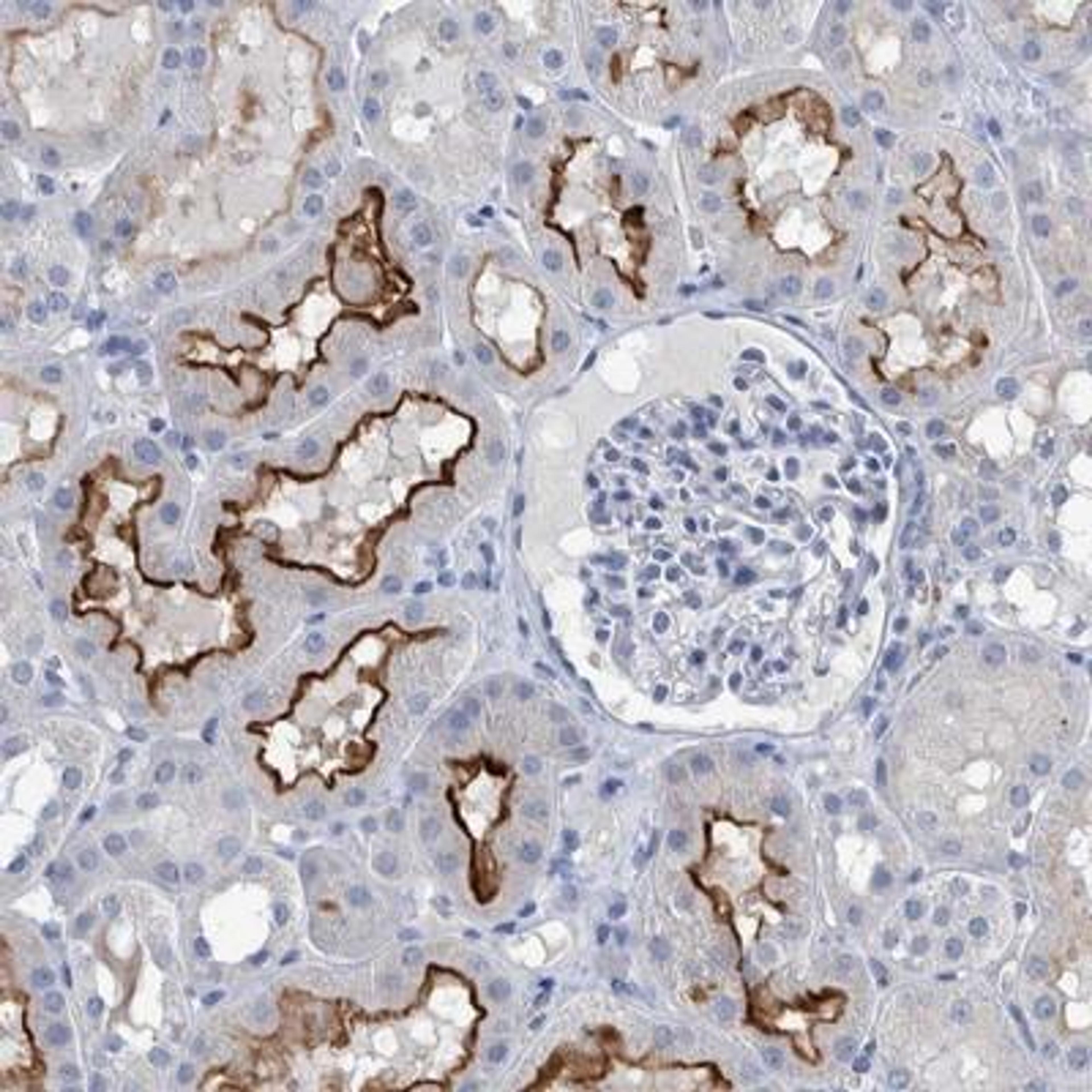 Immunohistochemistry: SLC34A3 Antibody [NBP1-81933] - Staining of human kidney shows distinct membranous positivity in cells in tubules.