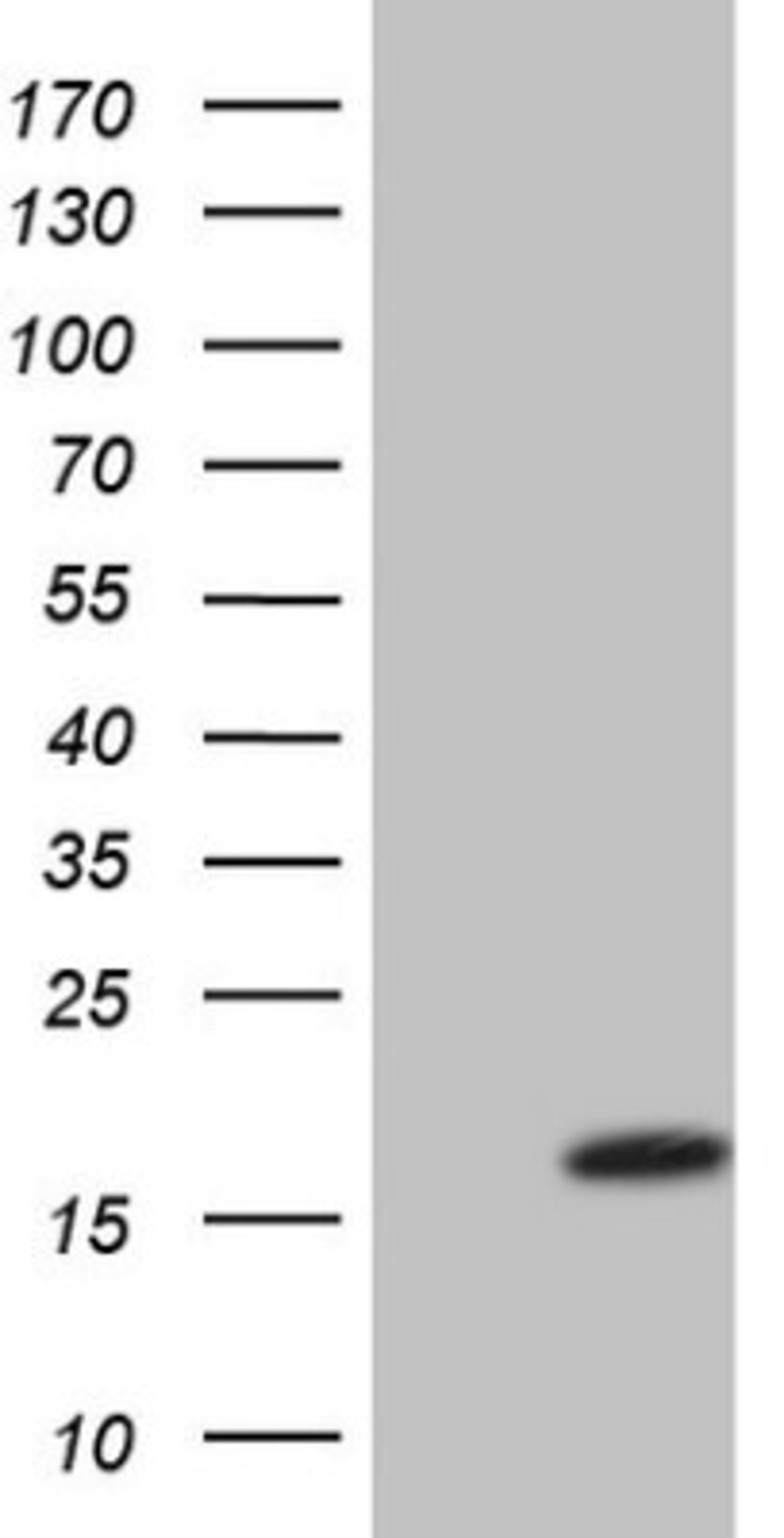 Western Blot: VIP Antibody (1E8) [NBP2-46349] - Analysis of HEK293T cells were transfected with the pCMV6-ENTRY control (Left lane) or pCMV6-ENTRY VIP.