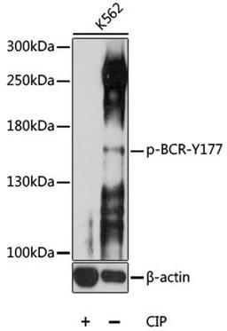 Western blot - Phospho-BCR-Y177 antibody (AP0606)