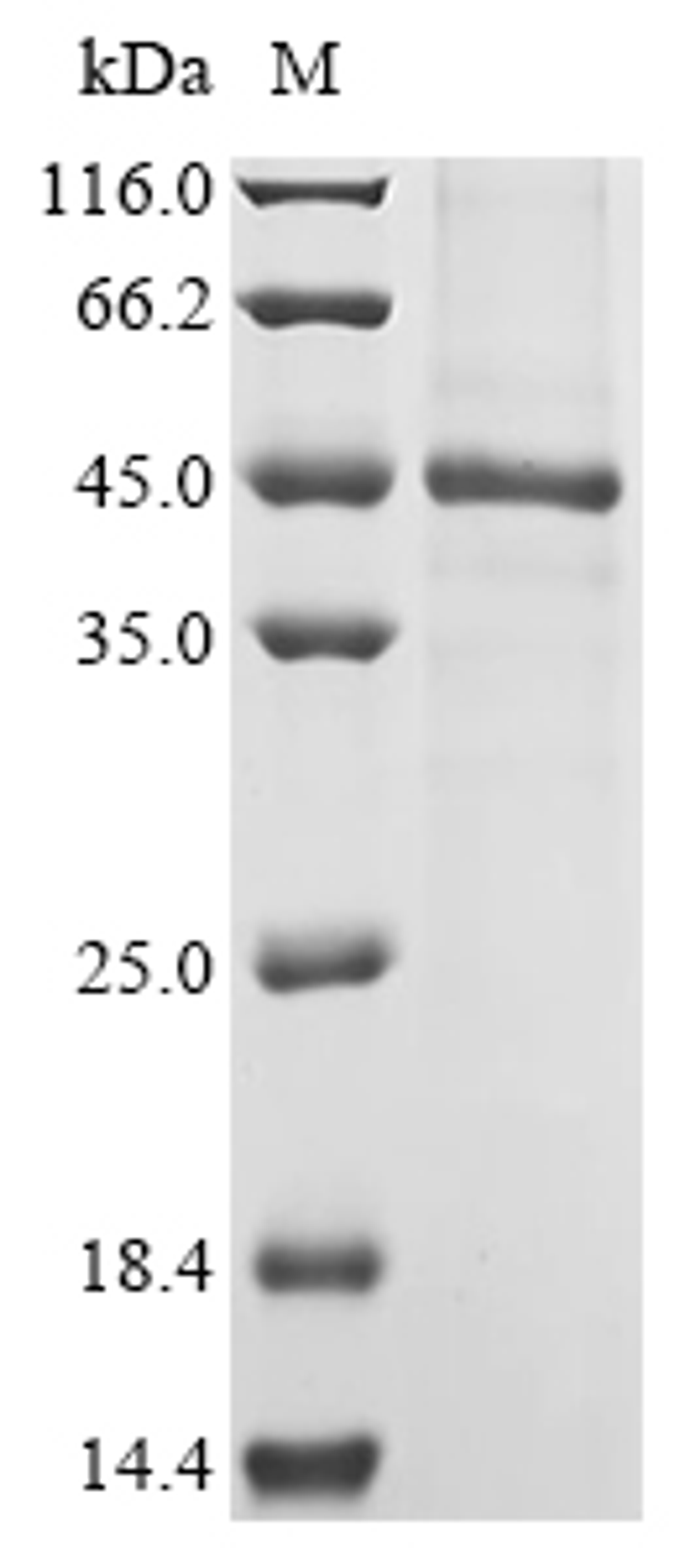 (Tris-Glycine gel) Discontinuous SDS-PAGE (reduced) with 5% enrichment gel and 15% separation gel.