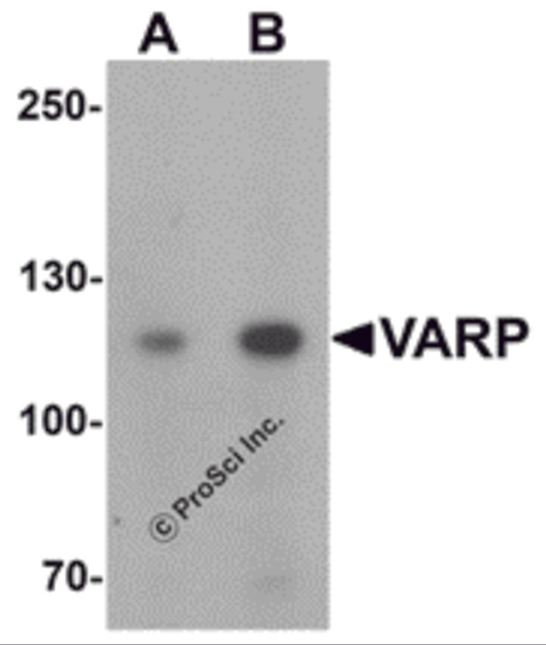 Western blot analysis of VARP in K562 cell lysate with VARP antibody at (A) 1 and (B) 2 μg/mL.