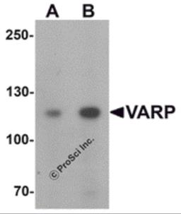 Western blot analysis of VARP in K562 cell lysate with VARP antibody at (A) 1 and (B) 2 μg/mL.