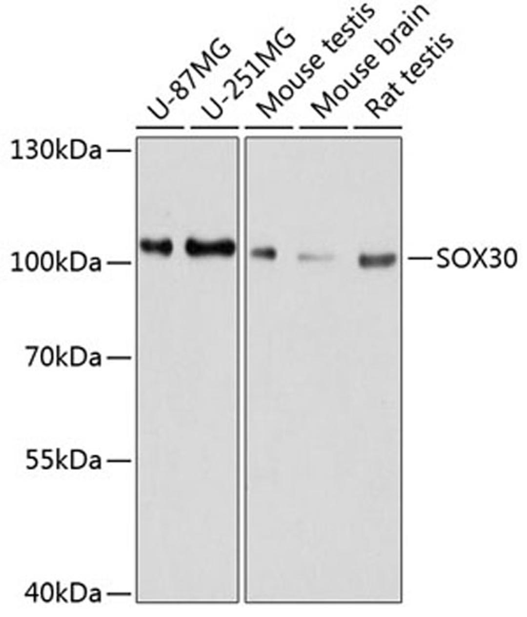 Western blot - SOX30 antibody (A11715)