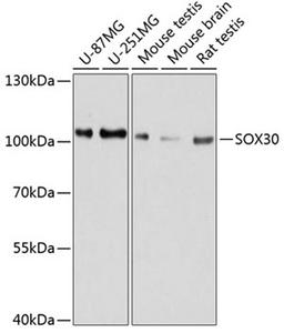 Western blot - SOX30 antibody (A11715)