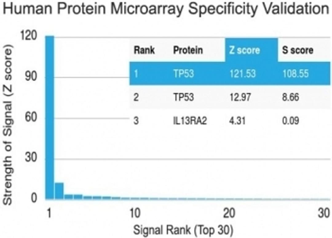 Analysis of HuProt(TM) microarray containing more than 19,000 full-length human proteins using p53 antibody (clone PAb 122).  Z- and S- score: The Z-score represents the strength of a signal that an antibody (in combination with a fluorescently-tagged ant