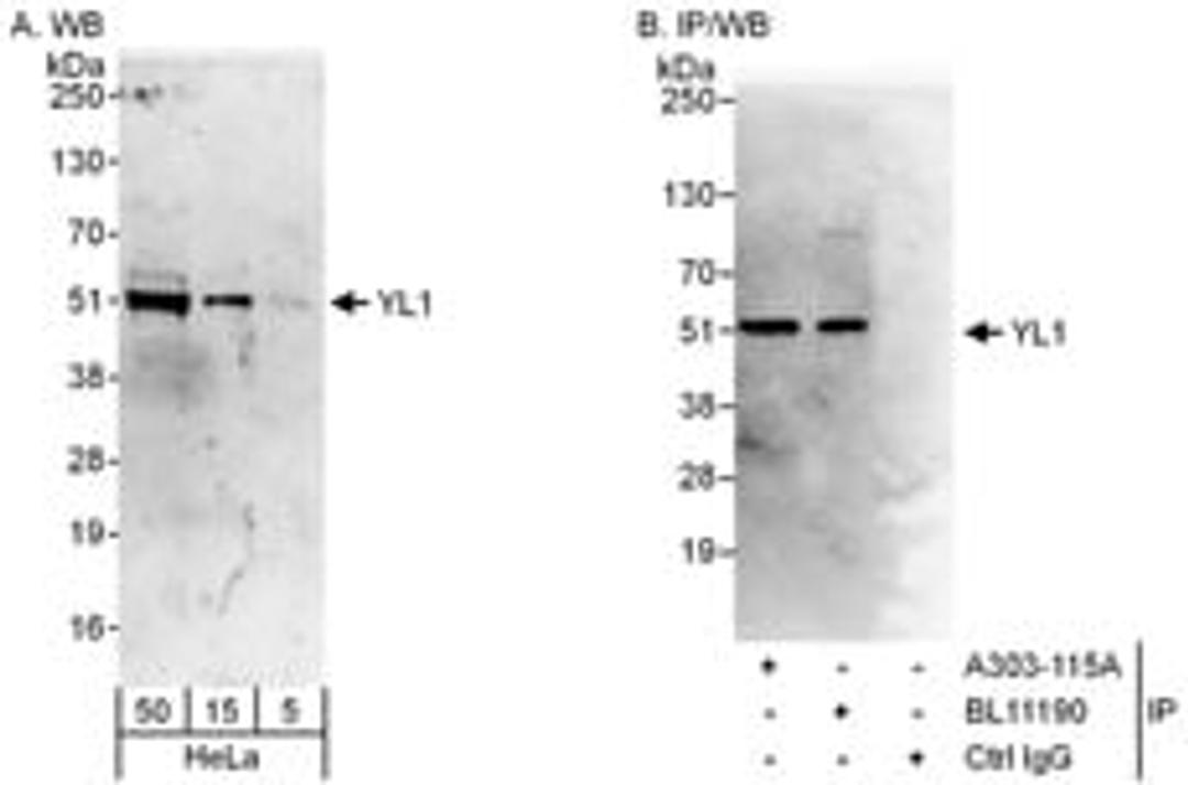 Detection of human YL1 by western blot and immunoprecipitation.