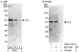 Detection of human YL1 by western blot and immunoprecipitation.