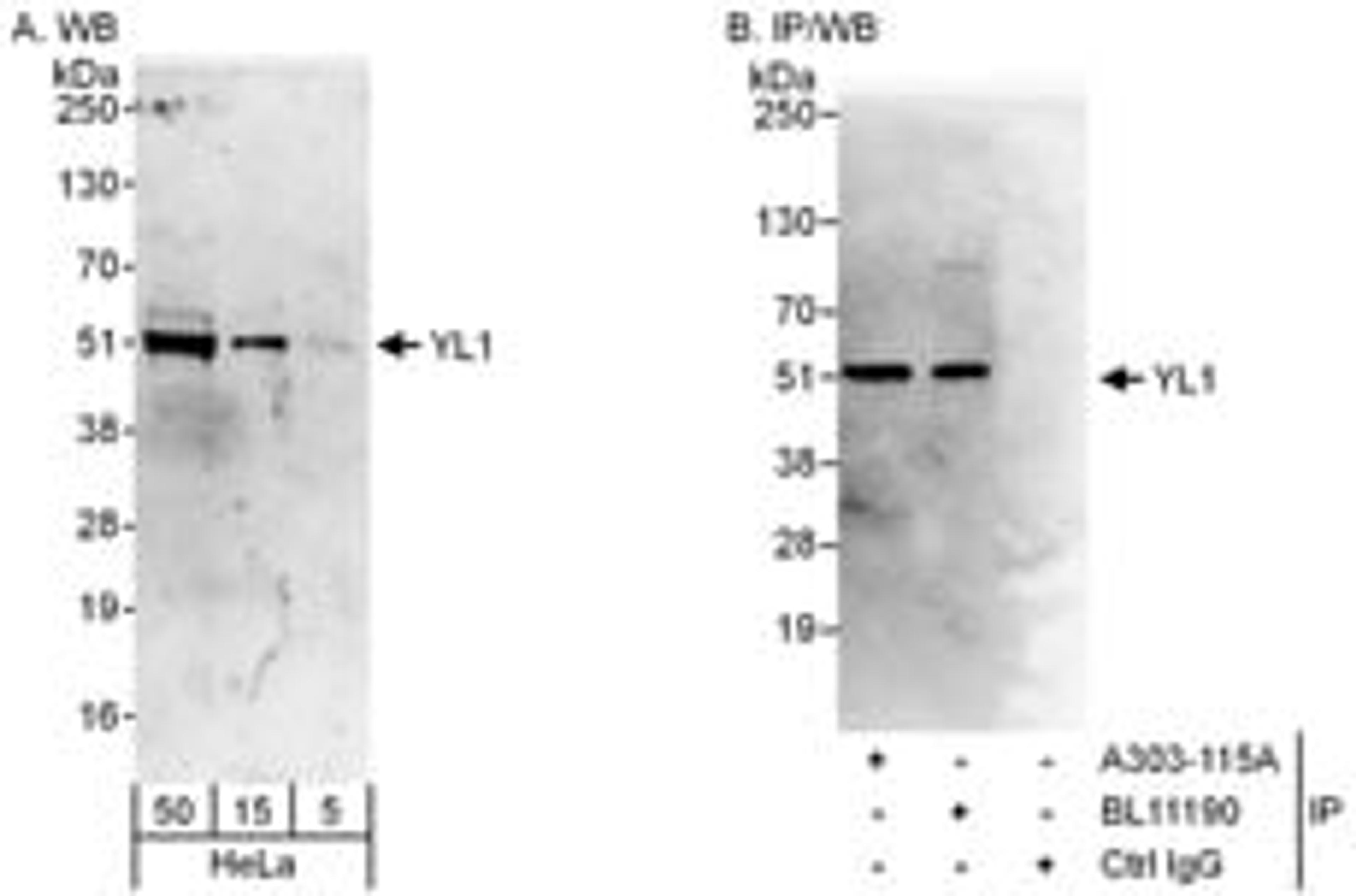 Detection of human YL1 by western blot and immunoprecipitation.