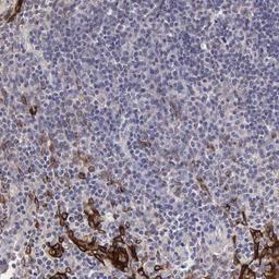 Immunohistochemistry-Paraffin: APOJ / Clusterin Antibody [NBP1-90128] - Staining of human tonsil shows strong positivity in squamous epithelial cells.