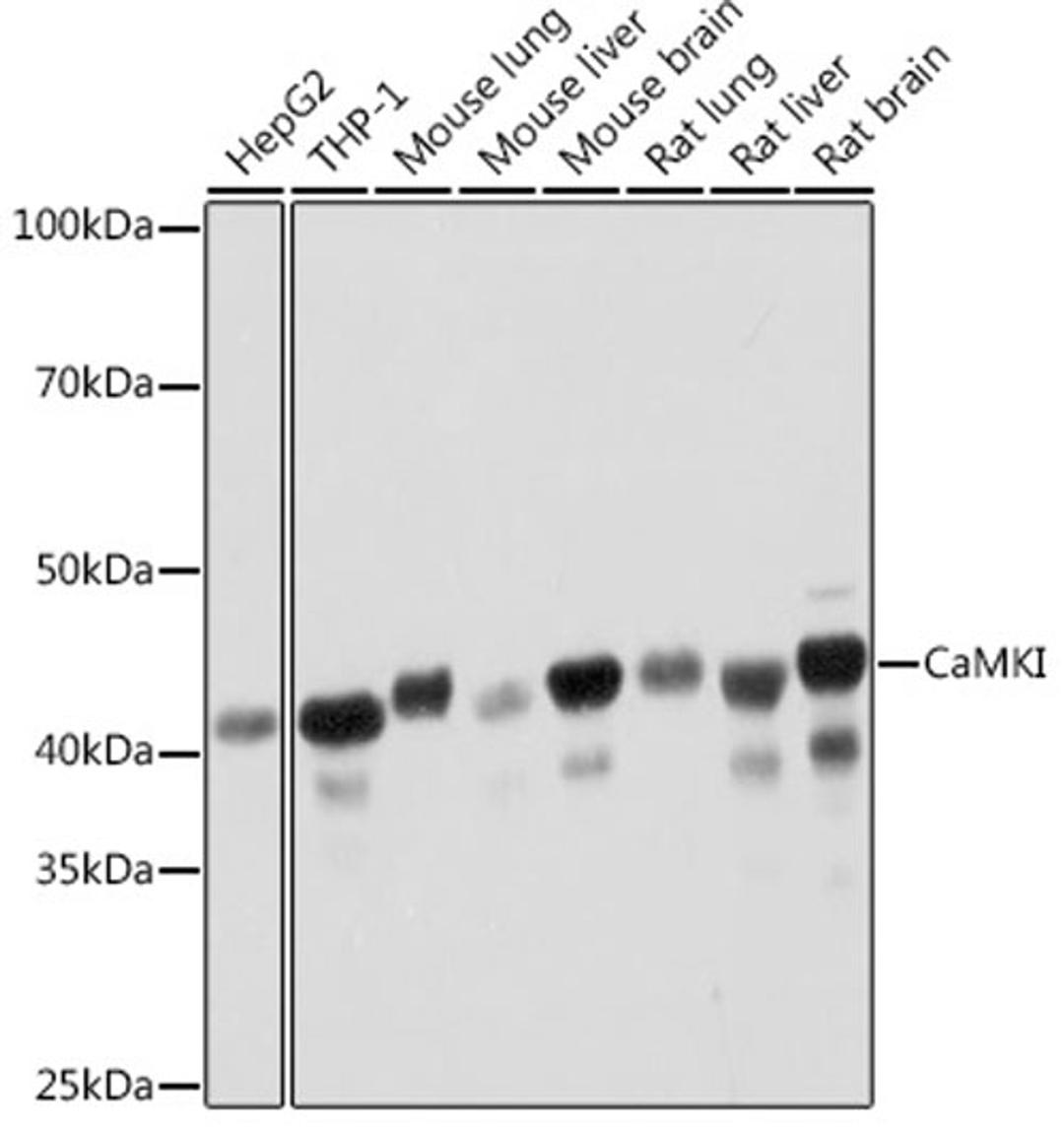 Western blot - CaMKI Rabbit mAb (A3529)