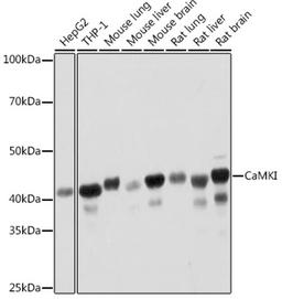 Western blot - CaMKI Rabbit mAb (A3529)