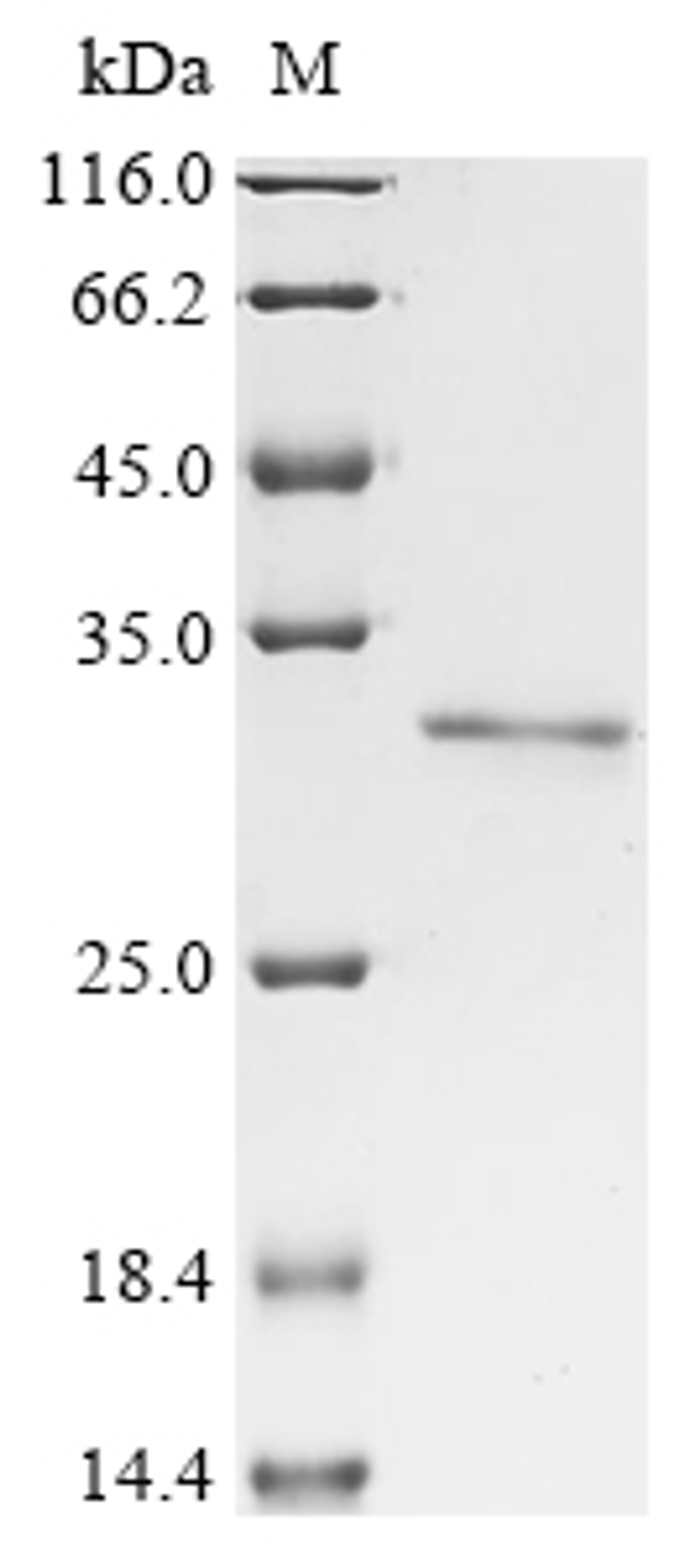 (Tris-Glycine gel) Discontinuous SDS-PAGE (reduced) with 5% enrichment gel and 15% separation gel.