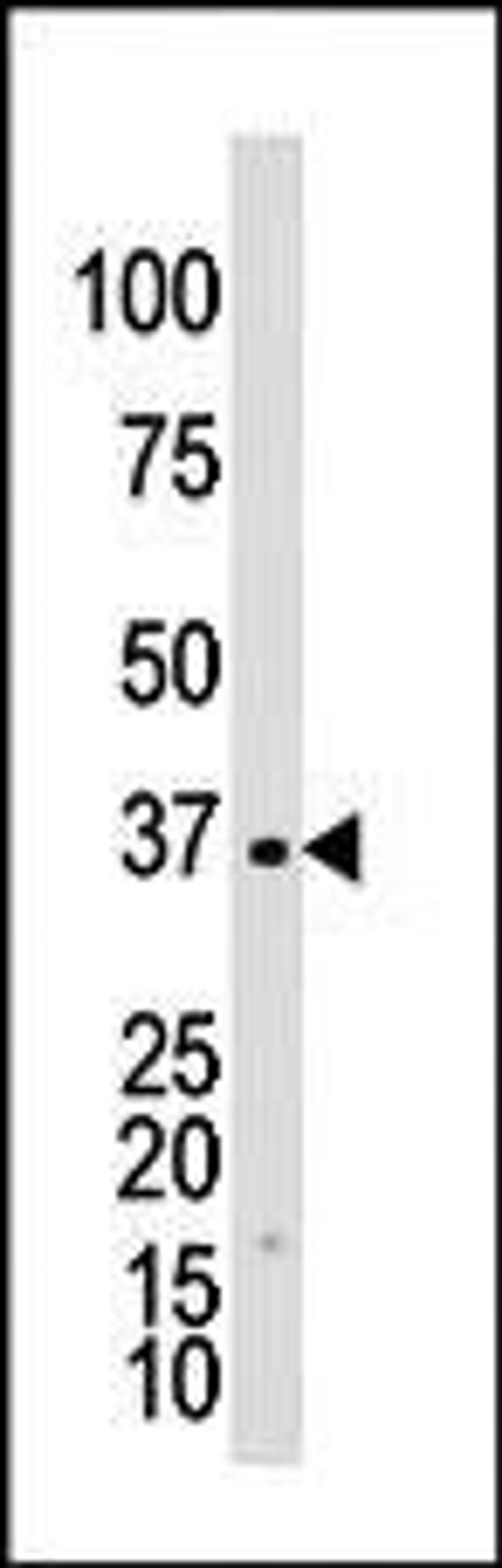 Antibody is used in Western blot to detect GALK1 in Y79 cell lysate.