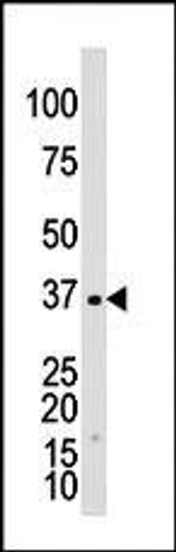 Antibody is used in Western blot to detect GALK1 in Y79 cell lysate.