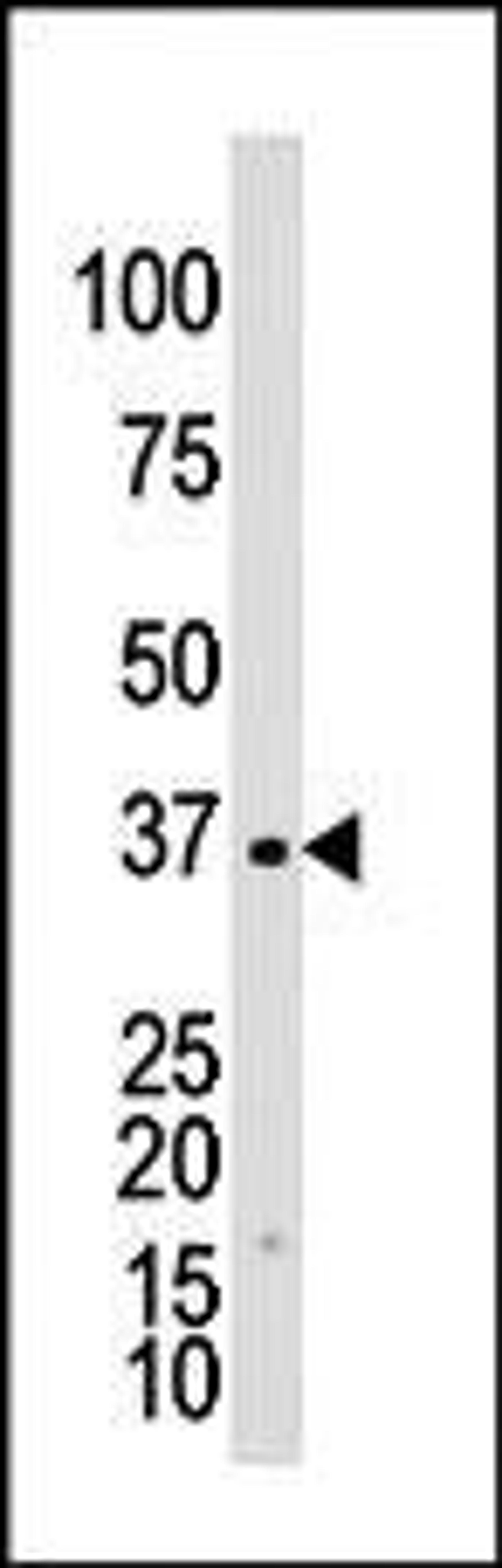 Antibody is used in Western blot to detect GALK1 in Y79 cell lysate.