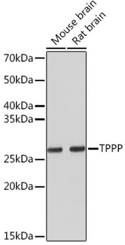 Western blot - TPPP Rabbit mAb (A4637)