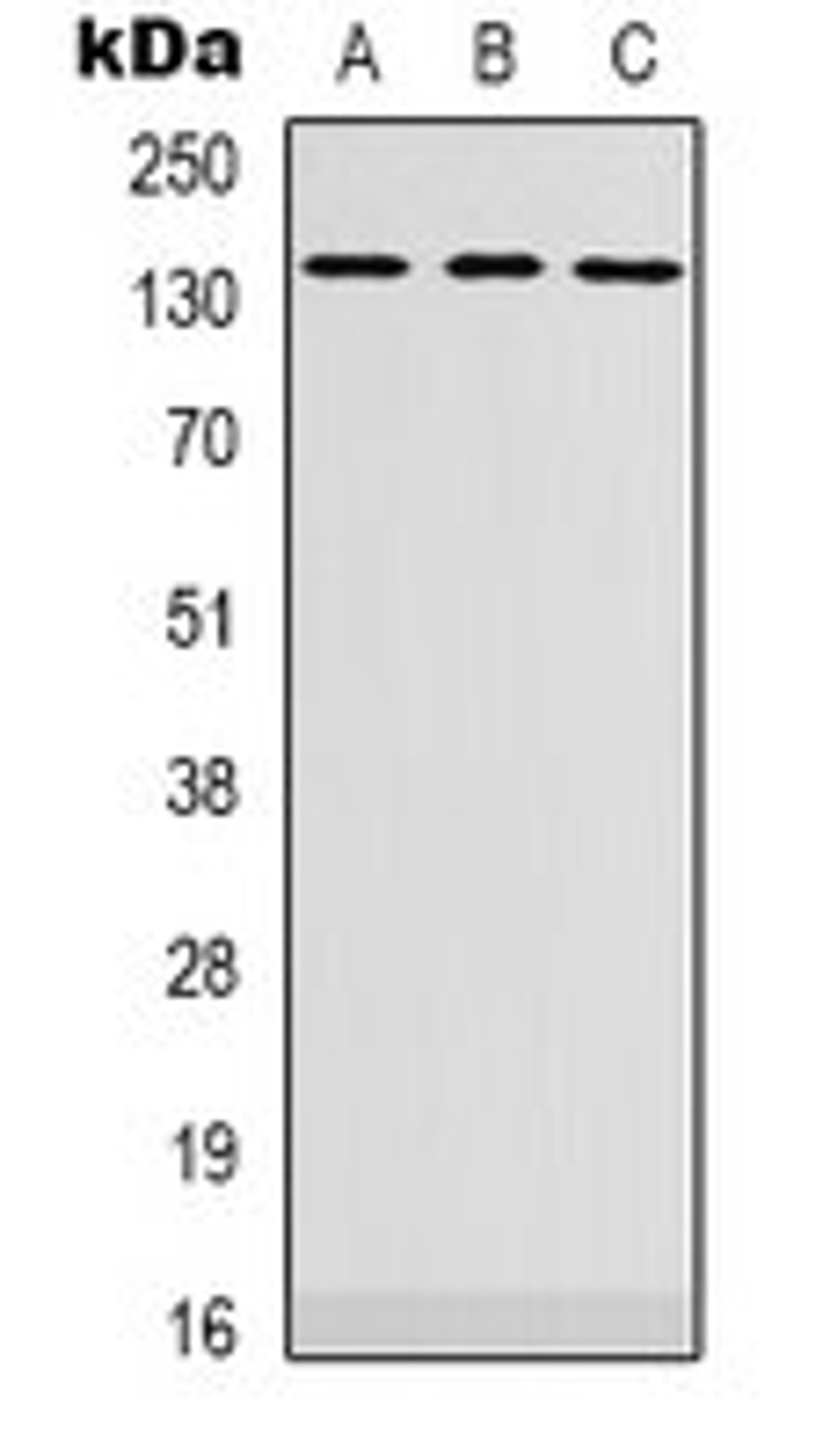 Western blot analysis of SHSY5Y (Lane 1), HEK293T (Lane 2), K562 (Lane 3) whole cell lysates using PLEKHG4 antibody