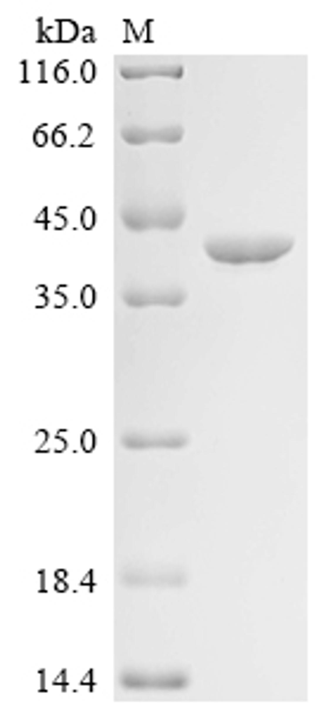 (Tris-Glycine gel) Discontinuous SDS-PAGE (reduced) with 5% enrichment gel and 15% separation gel.