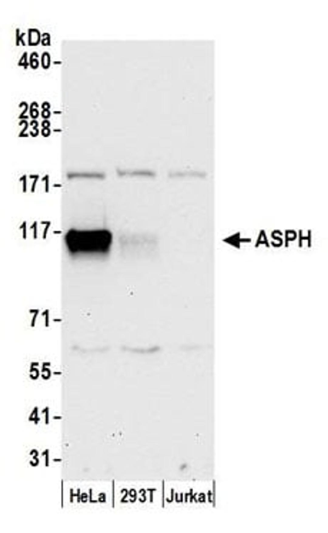 Detection of human ASPH by western blot.