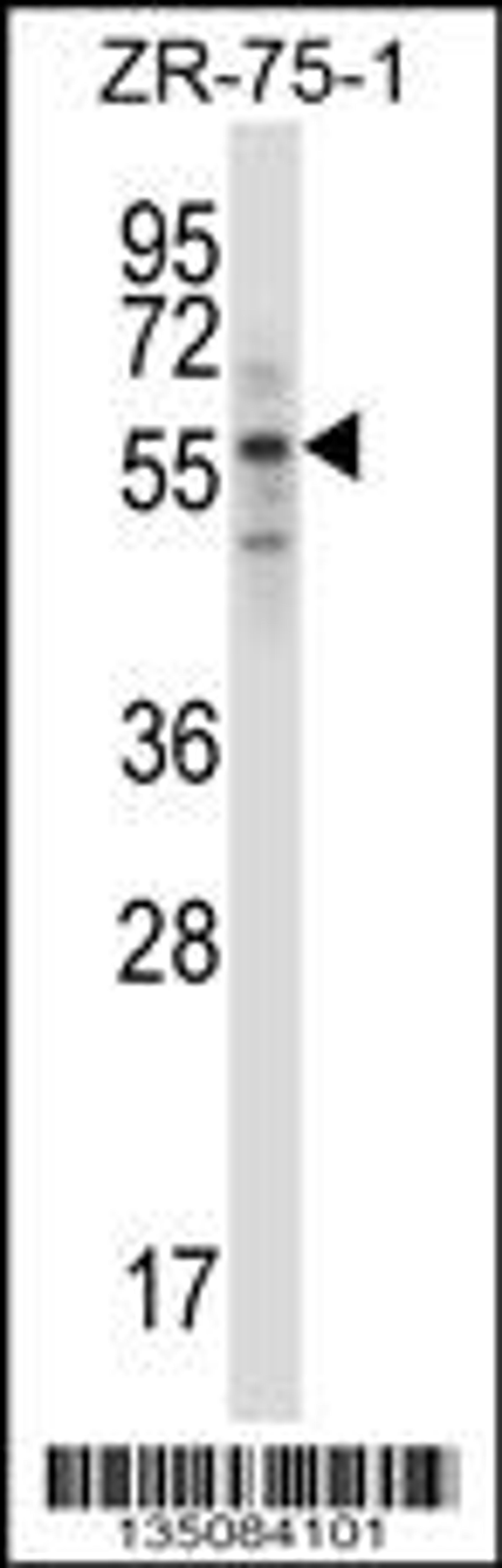 Western blot analysis in ZR-75-1 cell line lysates (35ug/lane).