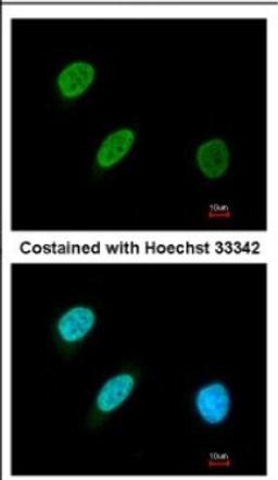 Immunocytochemistry/Immunofluorescence: BRF2 Antibody [NBP2-15617] - Immunofluorescence analysis of paraformaldehyde-fixed HeLa, using antibody at 1:200 dilution.