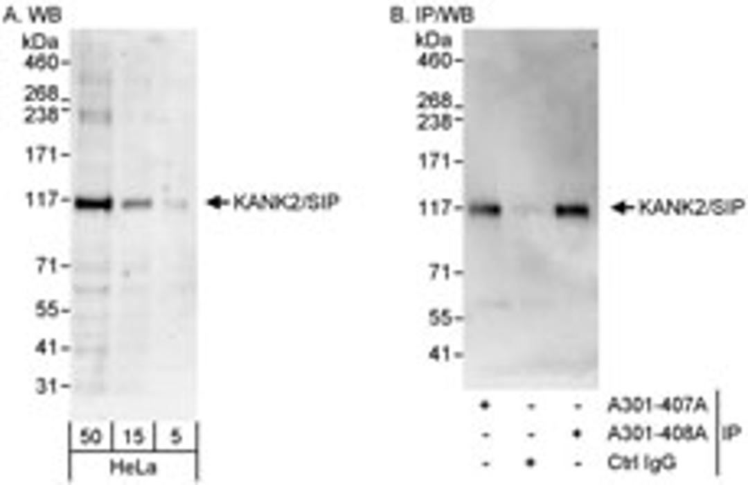 Detection of human KANK2/SIP by western blot and immunoprecipitation.