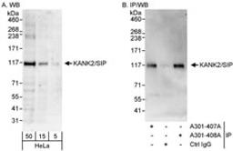 Detection of human KANK2/SIP by western blot and immunoprecipitation.