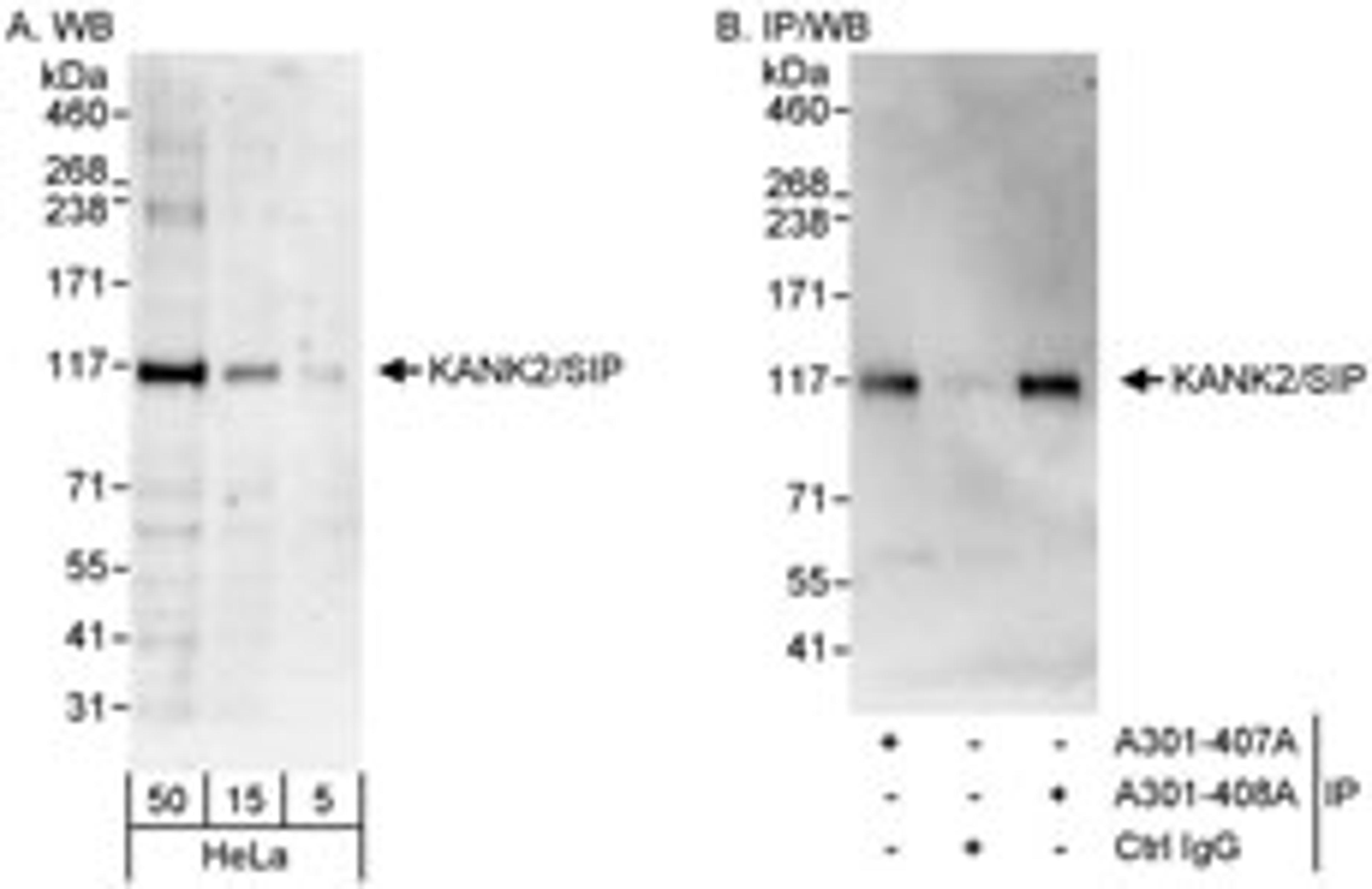 Detection of human KANK2/SIP by western blot and immunoprecipitation.