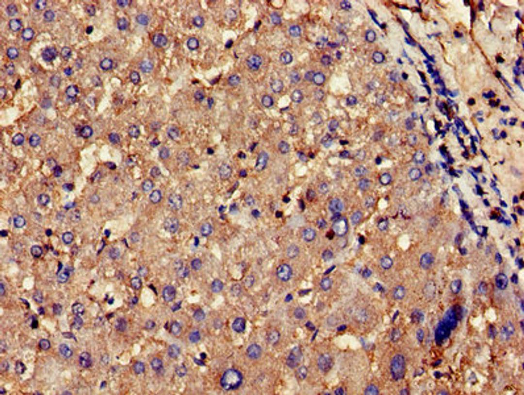 Immunohistochemistry of paraffin-embedded human liver tissue using CSB-PA005653LA01HU at dilution of 1:100