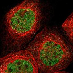 Immunocytochemistry/Immunofluorescence: LSECtin/CLEC4G Antibody [NBP1-82815] - Staining of human cell line A-431 shows positivity in nucleus but not nucleoli.