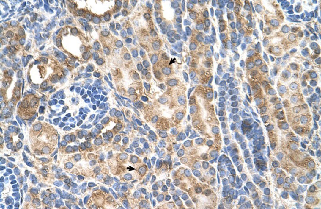 Antibody used in IHC on Human kidney.