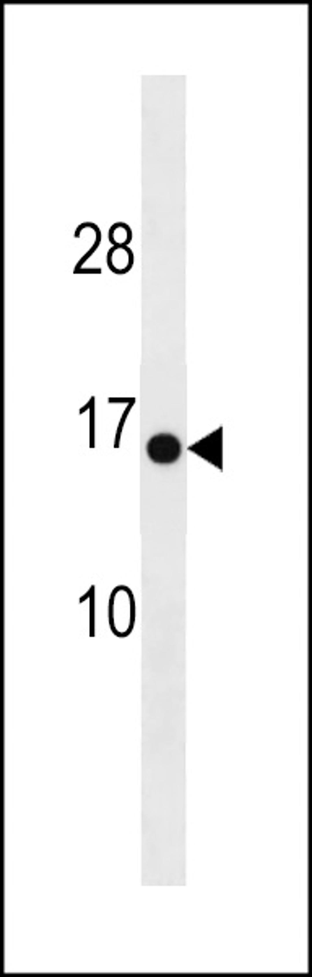 Western blot analysis in mouse heart tissue lysates (35ug/lane).