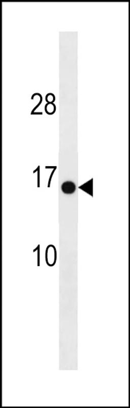 Western blot analysis in mouse heart tissue lysates (35ug/lane).