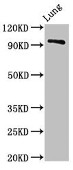 Western Blot. Positive WB detected in: Rat lung tissue. All lanes: VPS16 antibody at 3ug/ml. Secondary. Goat polyclonal to rabbit IgG at 1/50000 dilution. Predicted band size: 95, 79 kDa. Observed band size: 95 kDa. 