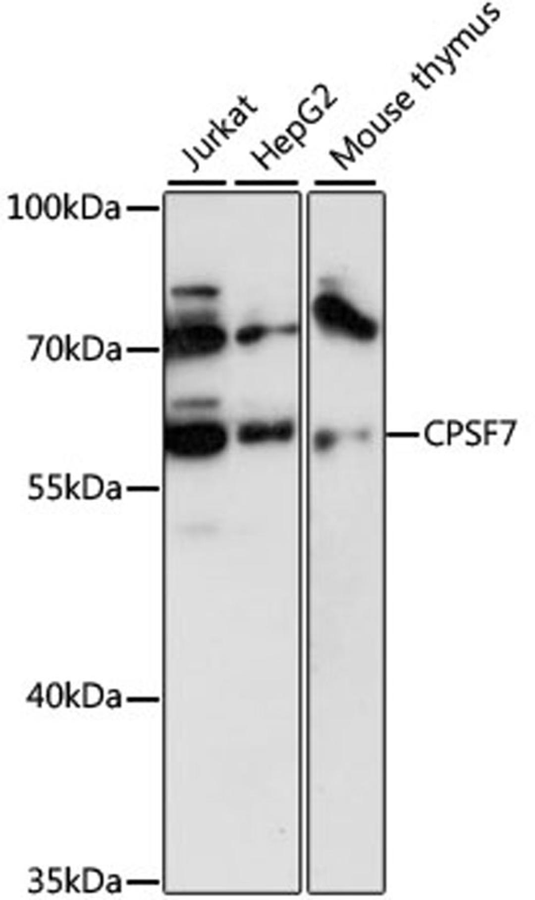 Western blot - CPSF7 antibody (A13880)