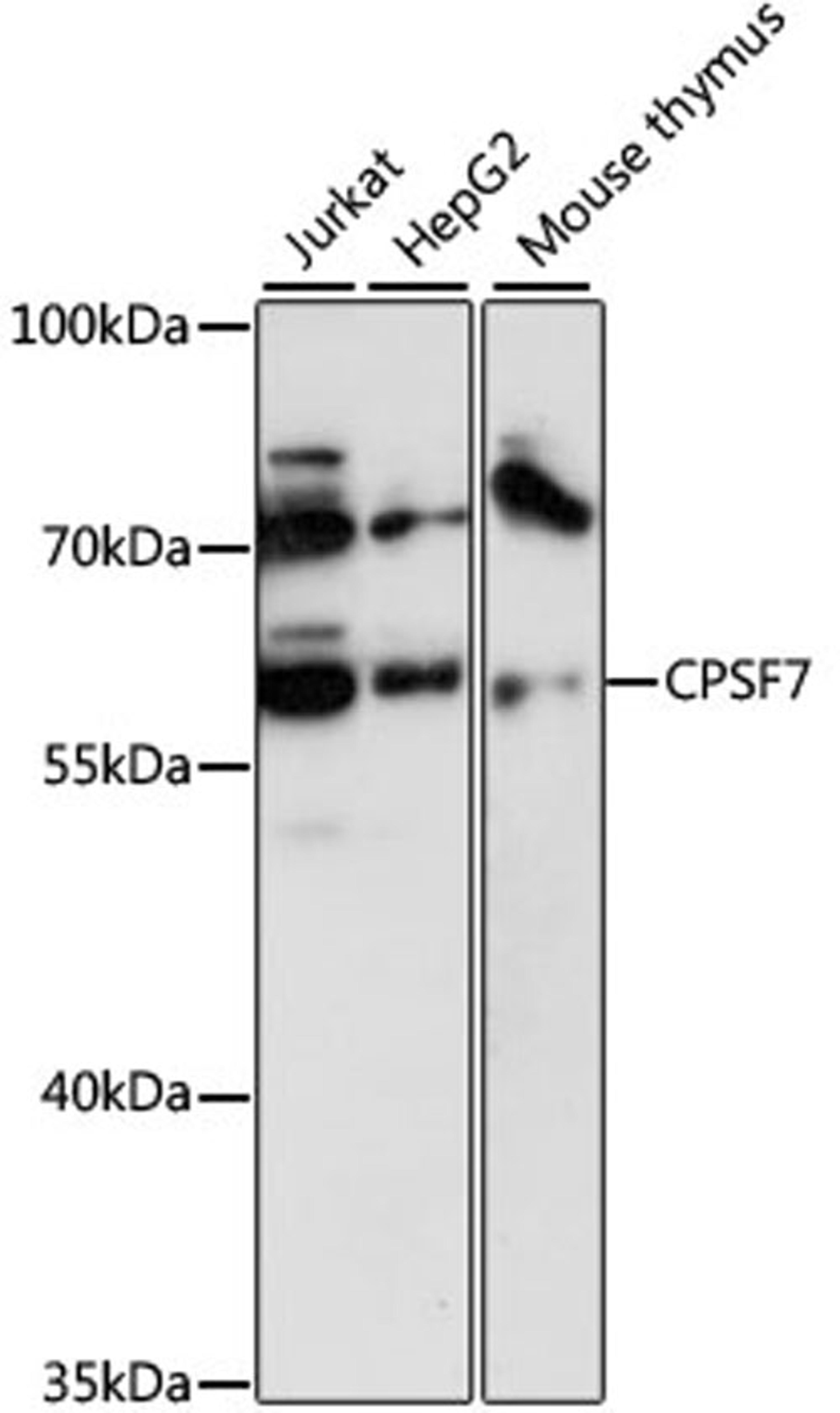 Western blot - CPSF7 antibody (A13880)