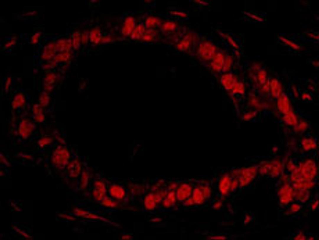 Detection of human DDX27 by immunohistochemistry.