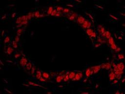 Detection of human DDX27 by immunohistochemistry.