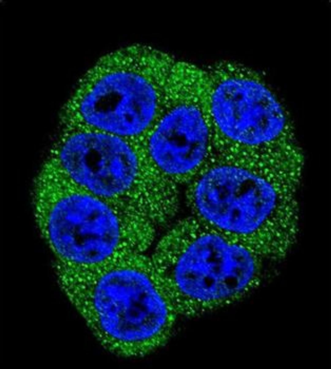 Immunofluorescense analysis of Hela cell using Fructose 6 Phosphate Kinase antibody (primary antibody dilution at: 1:10-50)