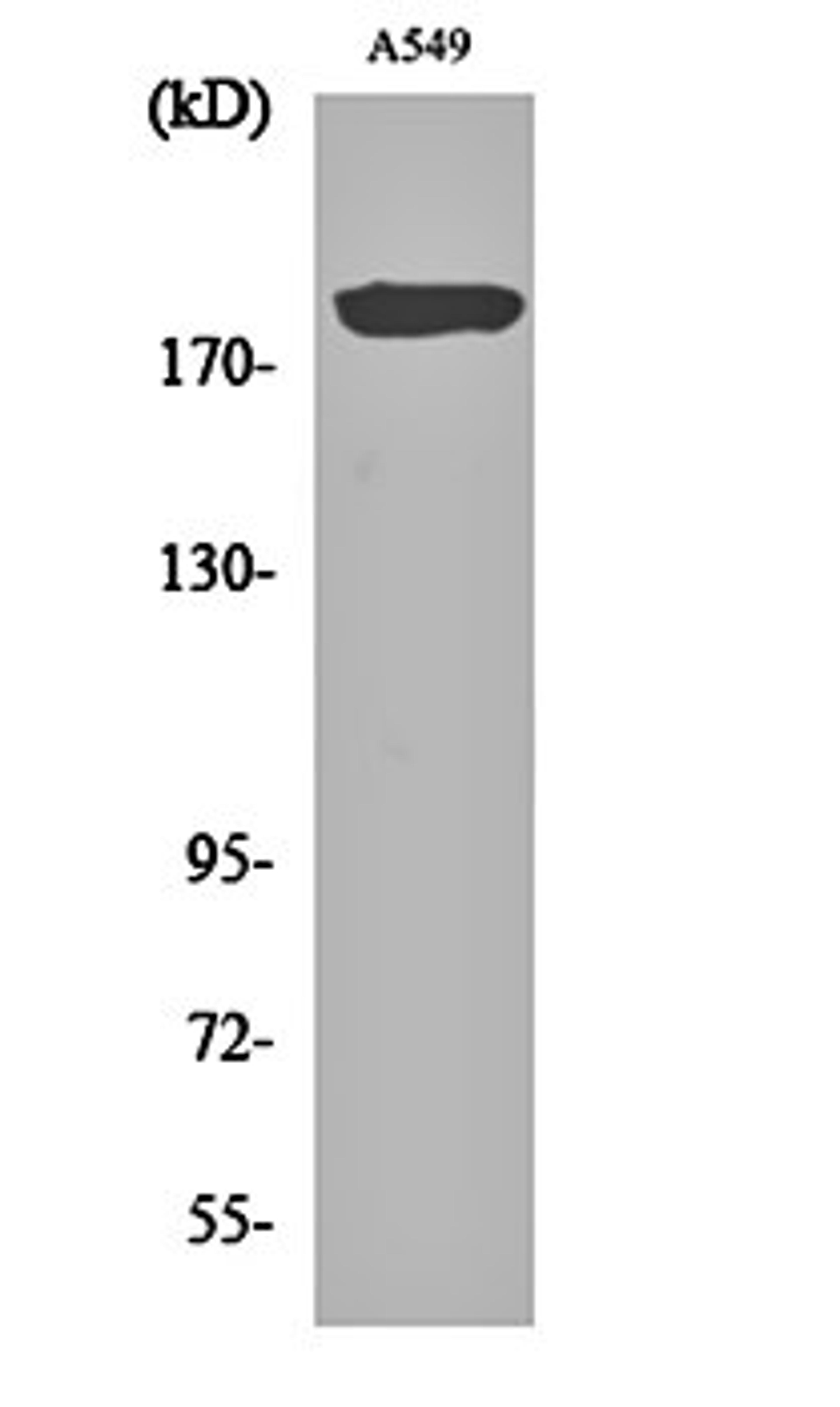 Western blot analysis of A549 cell lysates using BIG2 antibody