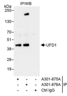 Detection of human UFD1 by western blot of immunoprecipitates.