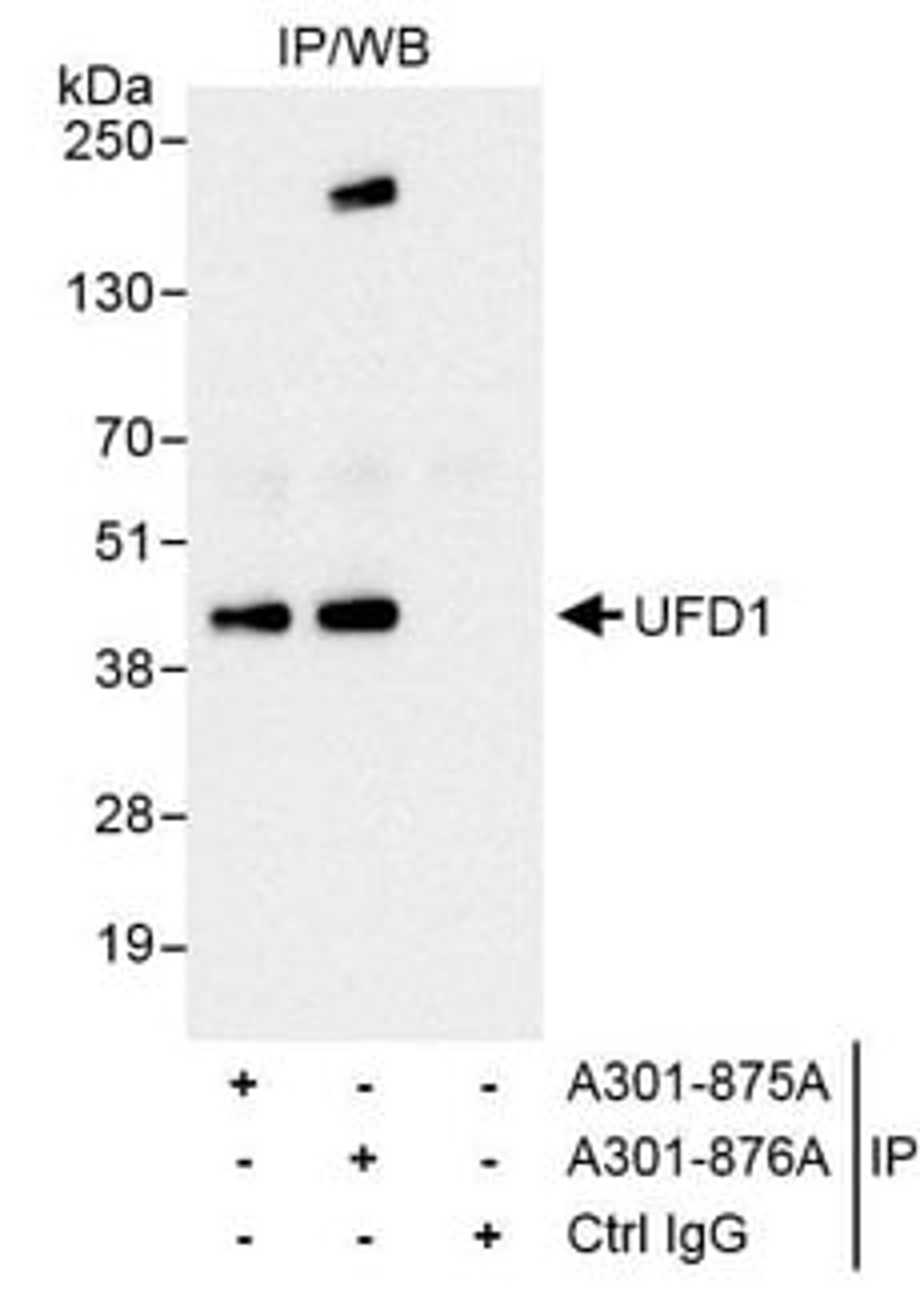 Detection of human UFD1 by western blot of immunoprecipitates.