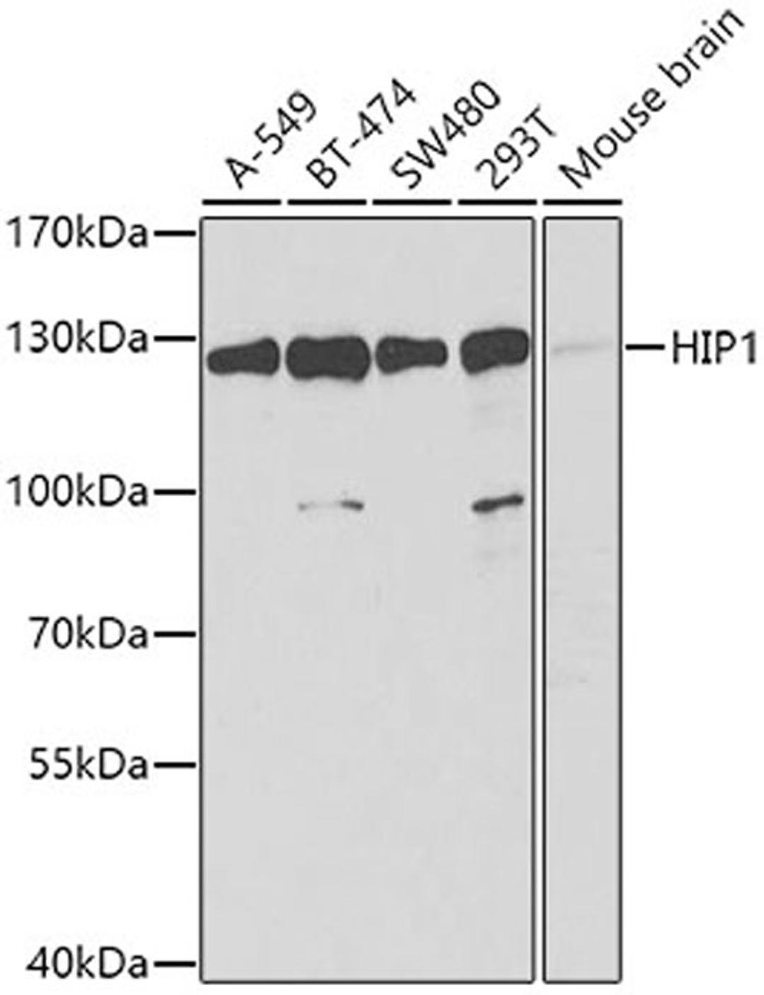 Western blot - HIP1 antibody (A6921)