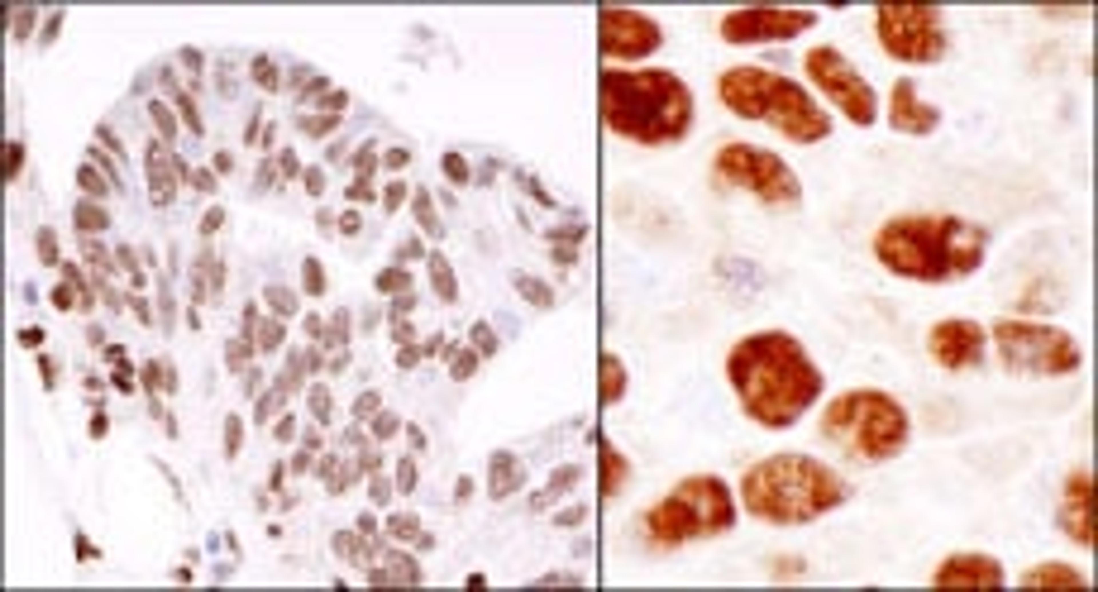 Detection of human and mouse hnRNP-K by immunohistochemistry.