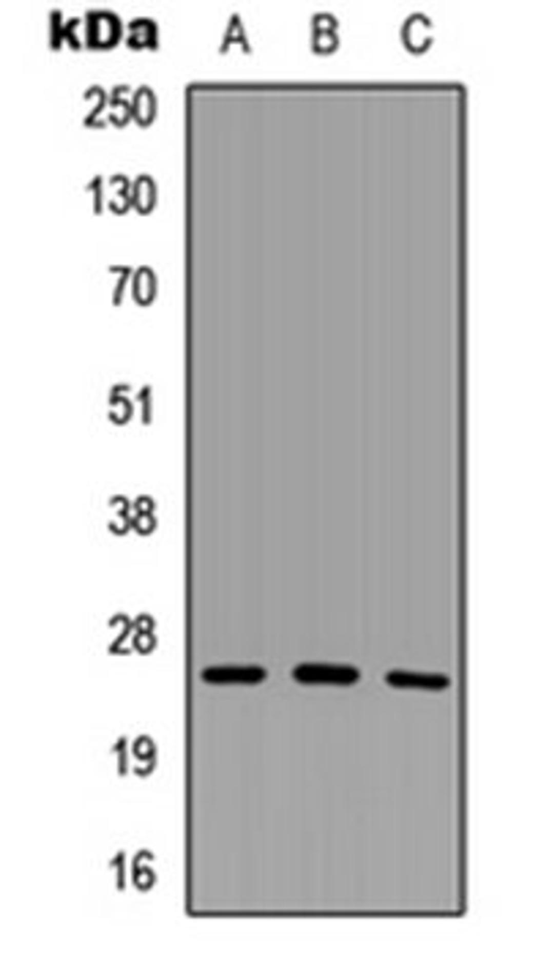 Western blot analysis of HeLa (Lane 1), Raw264.7 (Lane 2), H9C2 (Lane 3) whole cell lysates using SCNM1 antibody