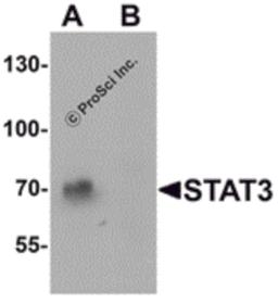 Western blot analysis of STAT3 in human small intestine tissue lysate with STAT3 antibody at 1 μg/mL in (A) the absence and (B) the presence of blocking peptide.