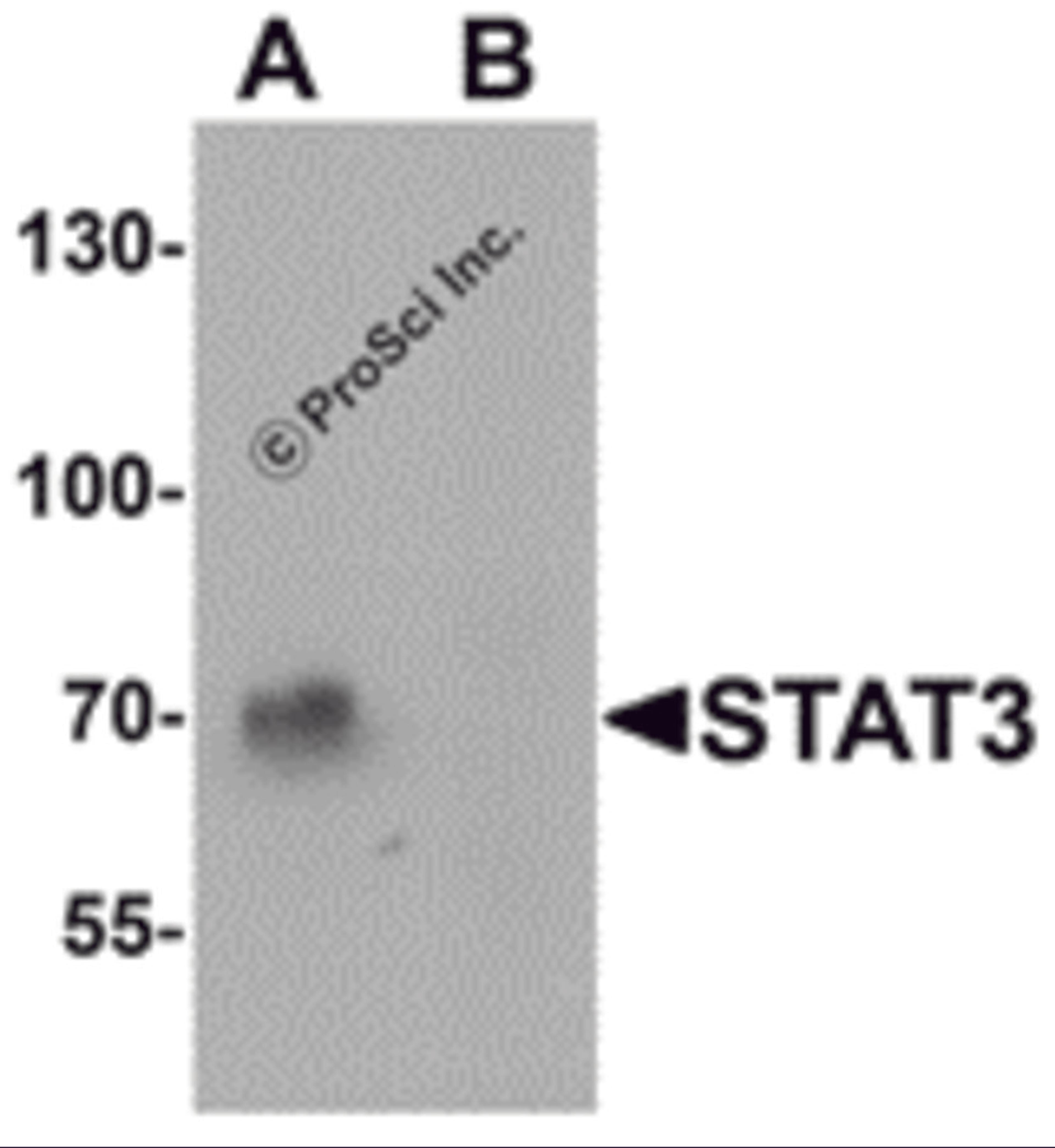 Western blot analysis of STAT3 in human small intestine tissue lysate with STAT3 antibody at 1 μg/mL in (A) the absence and (B) the presence of blocking peptide.