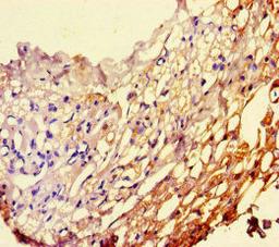 Immunohistochemistry of paraffin-embedded human thyroid tissue using CSB-PA017766HA01HU at dilution of 1:100