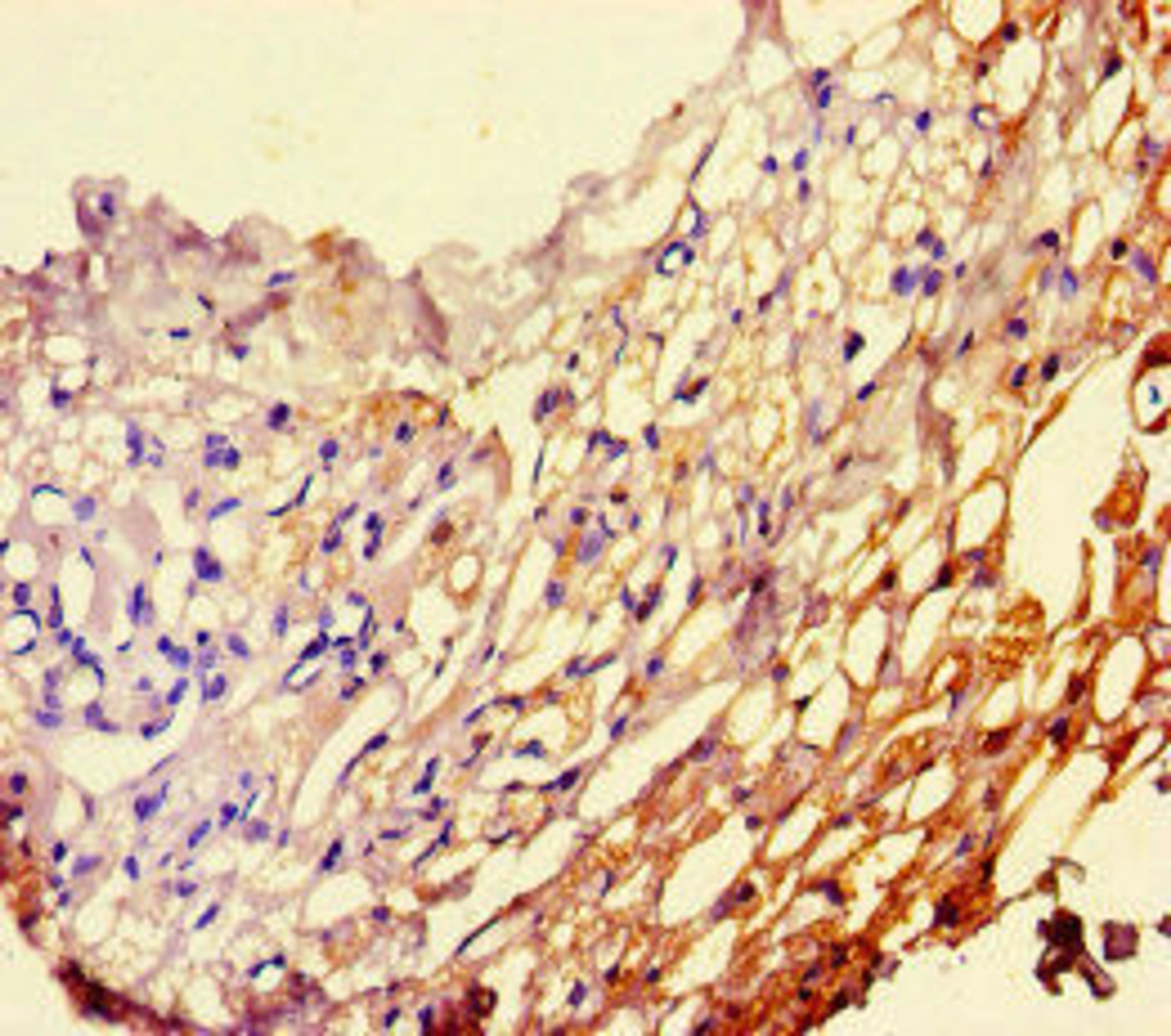 Immunohistochemistry of paraffin-embedded human thyroid tissue using CSB-PA017766HA01HU at dilution of 1:100